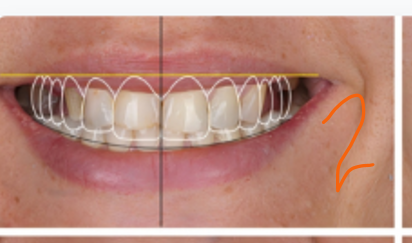 Digital Facial Analysis
