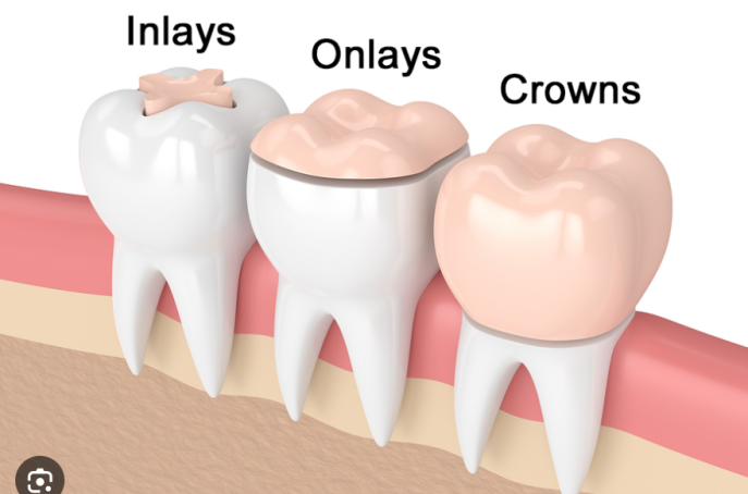 Comparison