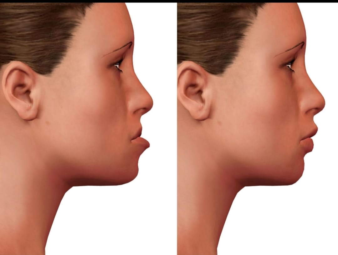 Facial Aesthetics